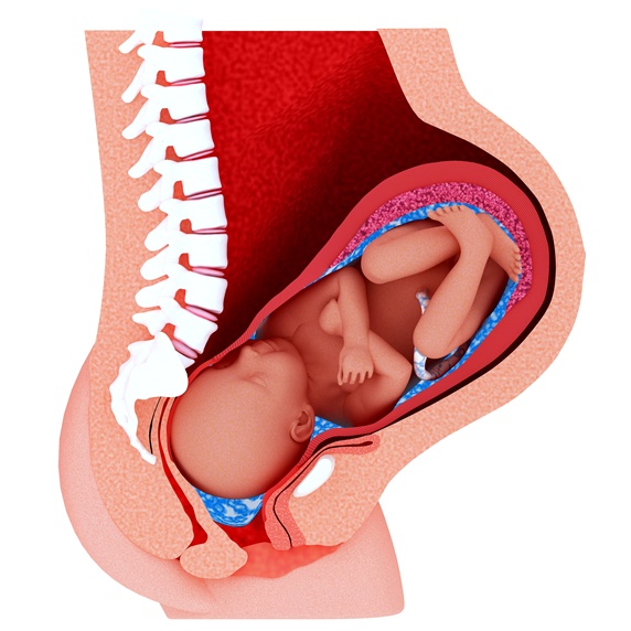 Cross section of womb with foetus being expelled