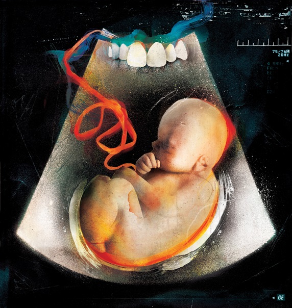 Illustration of X ray of fetus